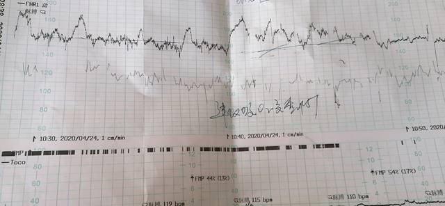 有胎心监护不过关的吗