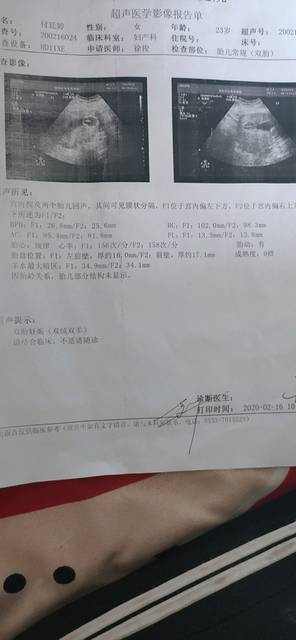 双绒双羊会变成单绒双羊吗?