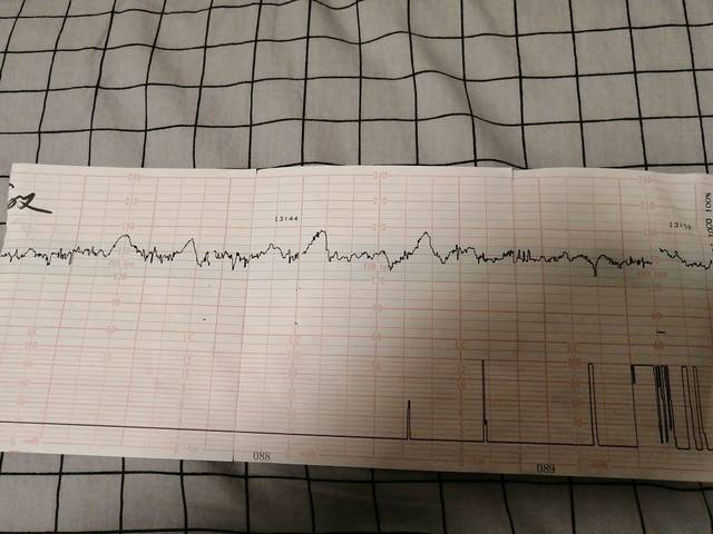 35周第一次胎心监护满分过关
