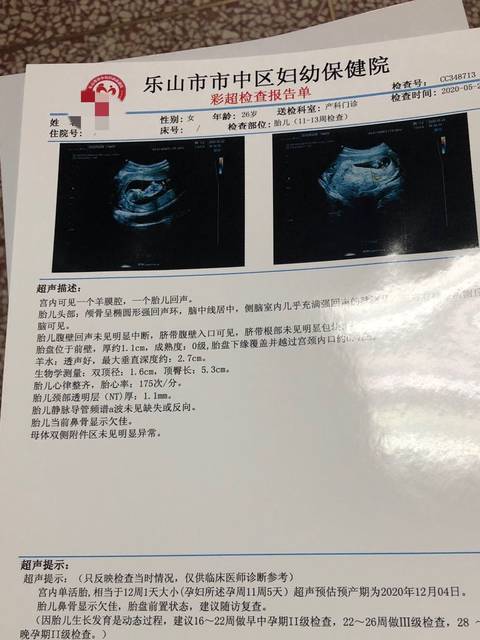 胎儿鼻骨显示欠佳,好担心啊