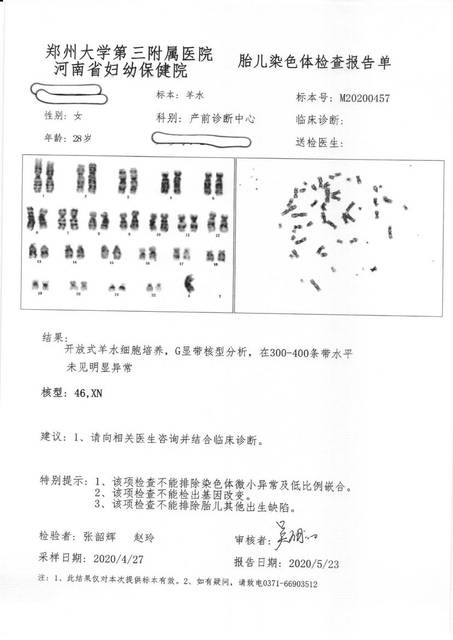 唐氏筛查21三体临界风险,羊穿核型和cma的单子出来了