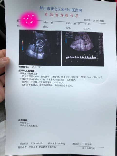 17周 1,能看出男女了吗?有点好奇