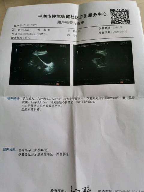 孕囊旁见月牙形液性暗区很危险吗,求大神帮我看看