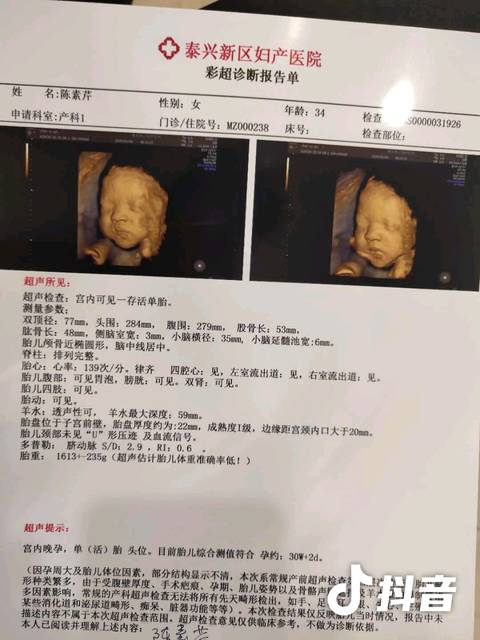 这是宝宝三十周四维