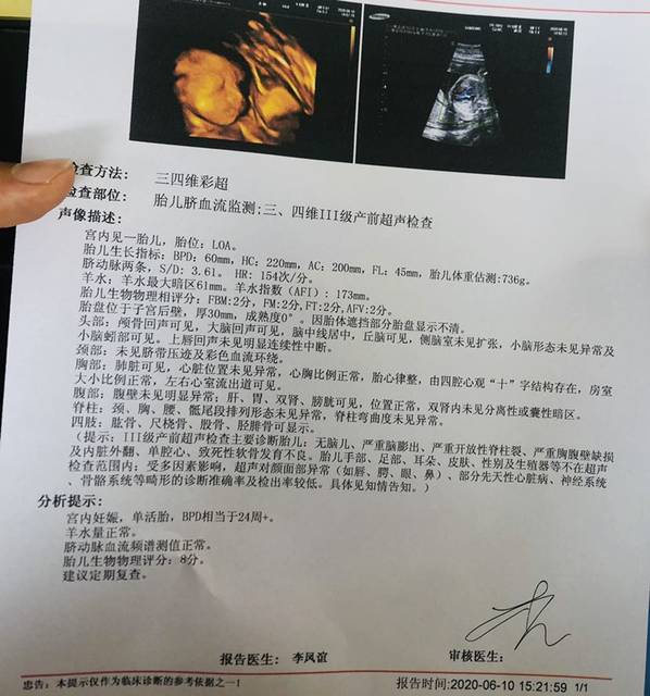 四维彩超顺利通过