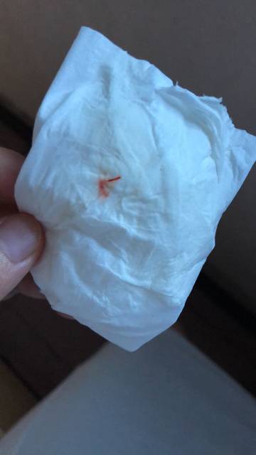37周2早上小便纸巾擦了有血丝,是否是见红了