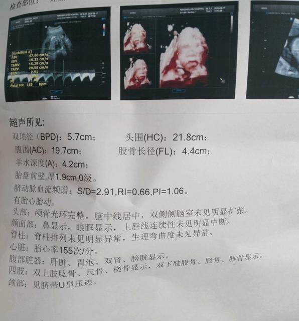 四维和心脏彩超顺利通过