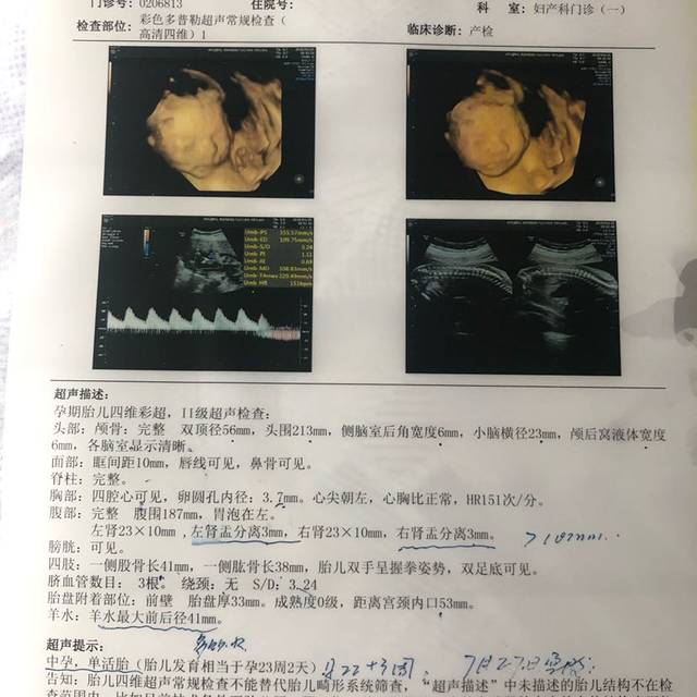 四维彩超