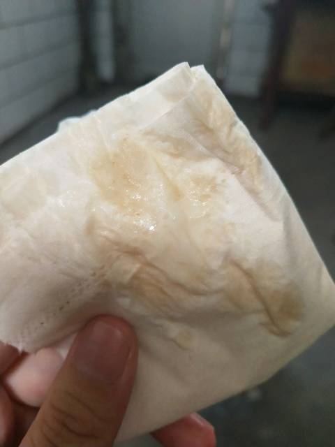 17周白色粘稠物