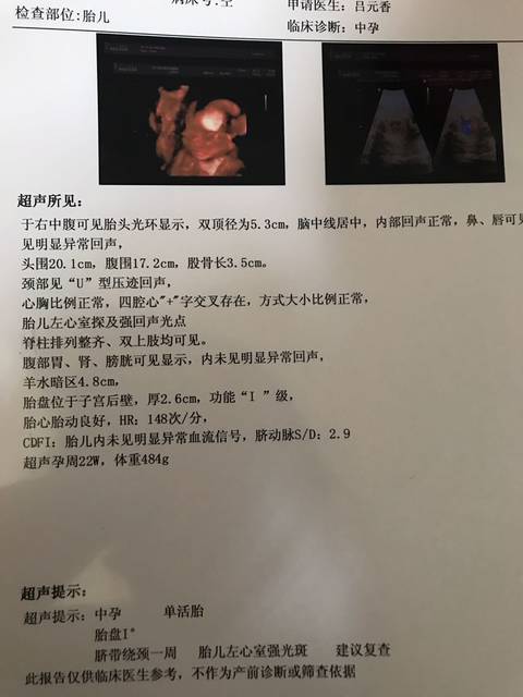 孕22周,四维