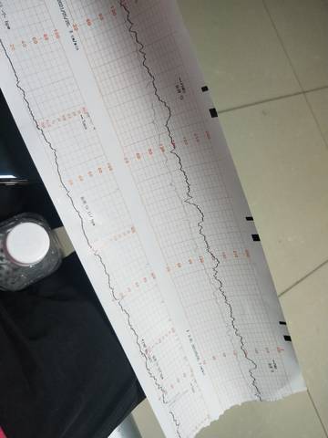 34周这个胎心监护正常吗?后面宫缩怎么一下到了70,就一下?