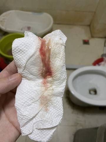 下面这个是见红吗 孕37周加4了 好紧张 害怕 担心 不认识是不是见红