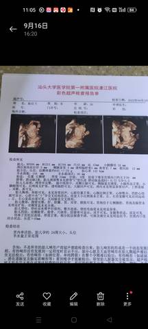 journal_insert_pic_1880457372