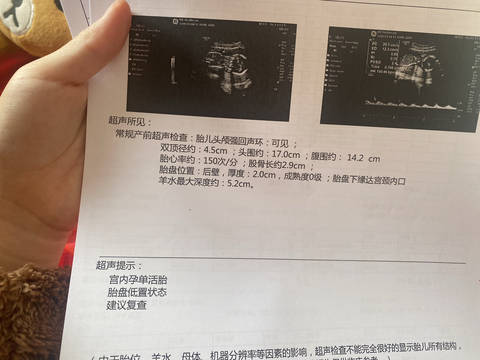 journal_insert_pic_4086267642