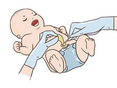 如何给新生儿护理肚脐?一定要注意这些,新妈妈