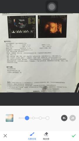journal_insert_pic_543480301