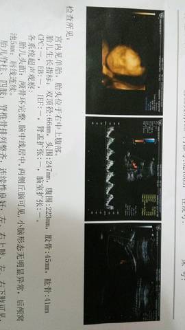 journal_insert_pic_544637261
