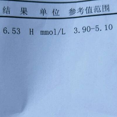 我的糖耐量出来了,大夫说我的血糖高,这个图是空腹的,我第二次结果是