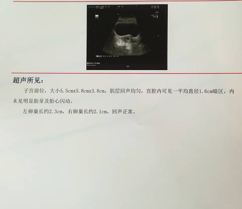 journal_insert_pic_545539538