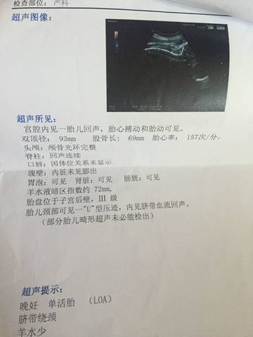 journal_insert_pic_547008789