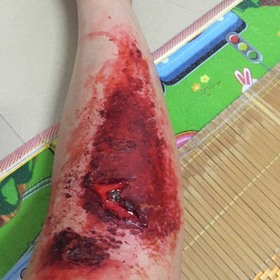 骑车摔伤高清图片图片
