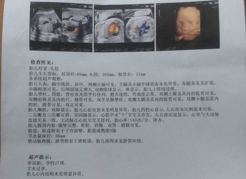 journal_insert_pic_554165024