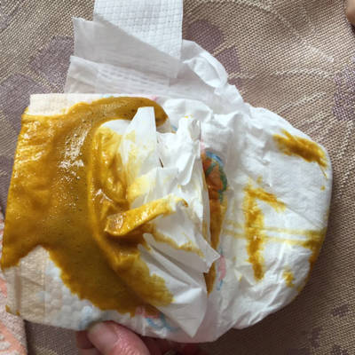 宝宝两个月,拉的糊糊状还有泡泡,已经有四天了,这正常吗?