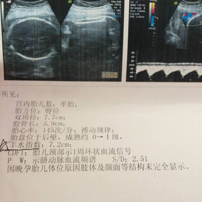 journal_insert_pic_557665936