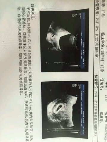 journal_insert_pic_560316360