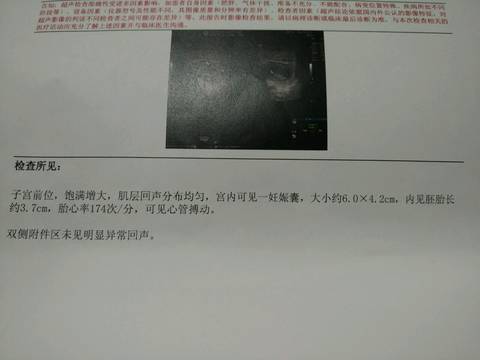 journal_insert_pic_560882845