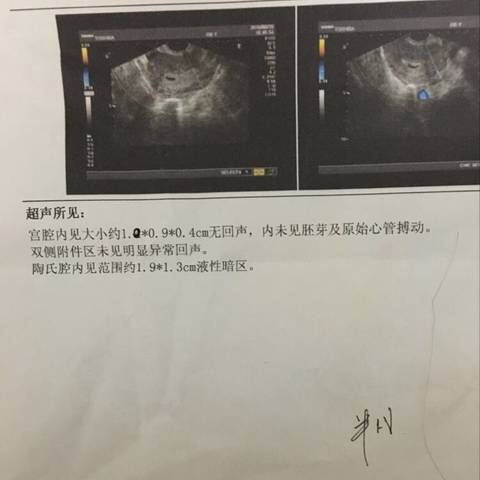 journal_insert_pic_562007605