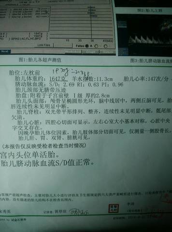 journal_insert_pic_562975742