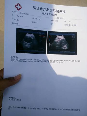 journal_insert_pic_562791178