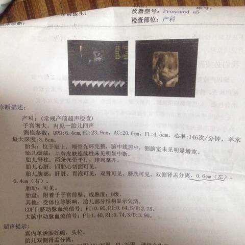 journal_insert_pic_563909212