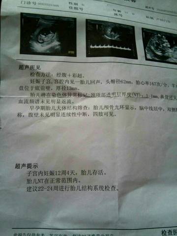 journal_insert_pic_564496144