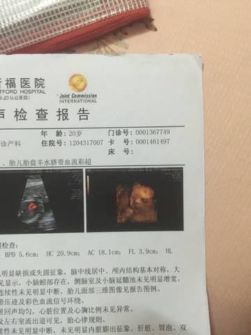 journal_insert_pic_566126628