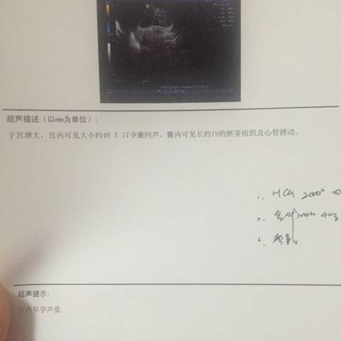 journal_insert_pic_566574954