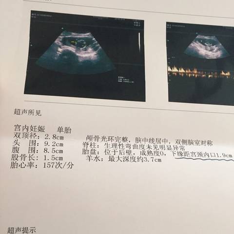 journal_insert_pic_568465684