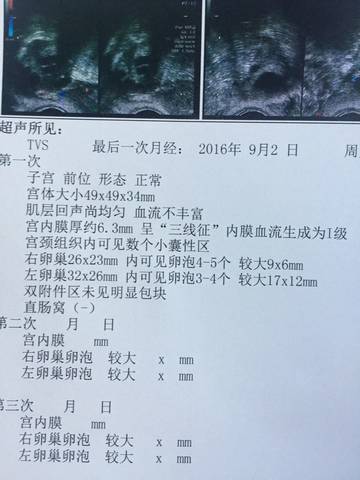 journal_insert_pic_569225903