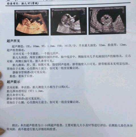 journal_insert_pic_569578846