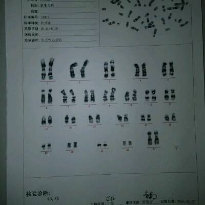 染色體檢查河北省醫保能不能報銷 染色體檢查醫保能報銷嘛
