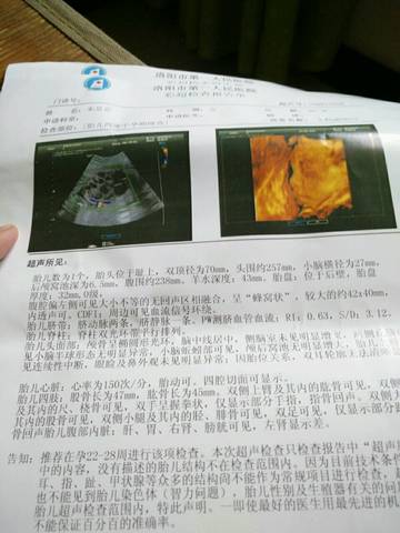 journal_insert_pic_570561833