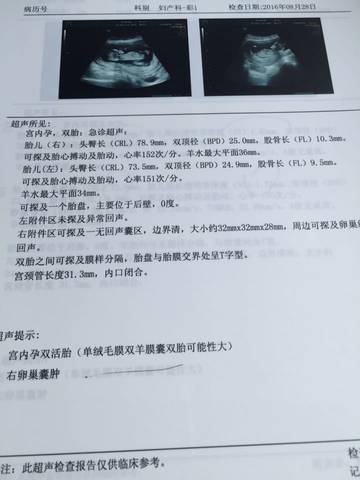 journal_insert_pic_570912385