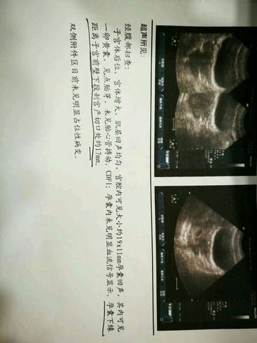 journal_insert_pic_572129342