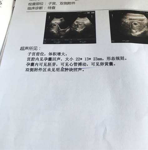 journal_insert_pic_574446528