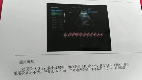 journal_insert_pic_574433361