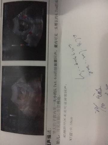journal_insert_pic_575391932
