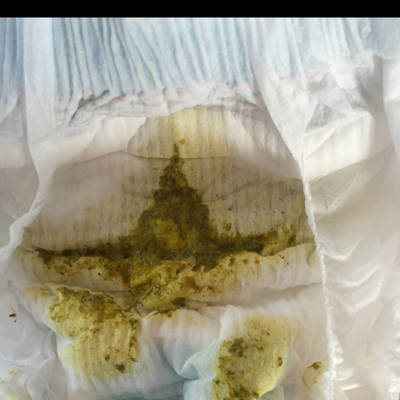 我家宝宝三个半月了,最近总是每次吃奶都拉粑粑,有时候还有泡沫,有点