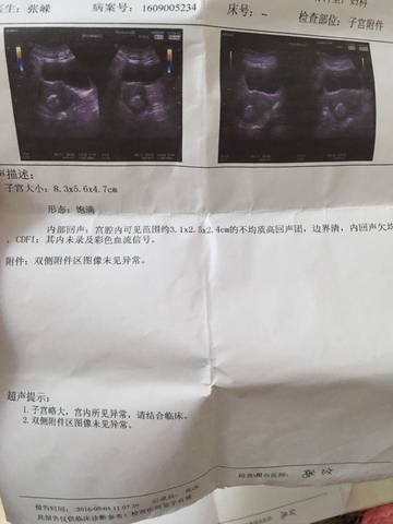 journal_insert_pic_576483158
