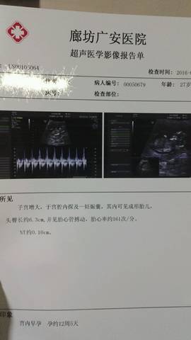 journal_insert_pic_577164655